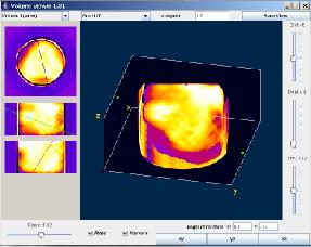 ボリューム再構築後の3D線量分布の可視化